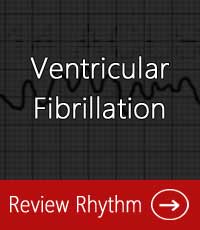 Interpret Ekgs Strips Like A Boss Ekg Interpretation For Nurses