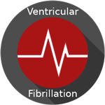 ventricular fibrillation heart